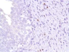 Immunohistochemistry (Formalin/PFA-fixed paraffin-embedded sections) - Anti-FOXP3 antibody [SP97] - BSA and Azide free (AB238809)