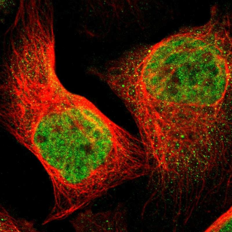 Immunocytochemistry/ Immunofluorescence - Anti-FOXP4 antibody (AB251688), expandable thumbnail