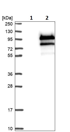 Western blot - Anti-FOXP4 antibody (AB251688), expandable thumbnail