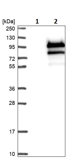 Western blot - Anti-FOXP4 antibody (AB251688)