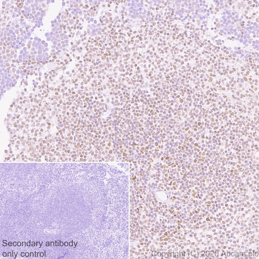 Immunohistochemistry (Formalin/PFA-fixed paraffin-embedded sections) - Anti-FOXP4 antibody [EPR22714-2] (ab242127), expandable thumbnail