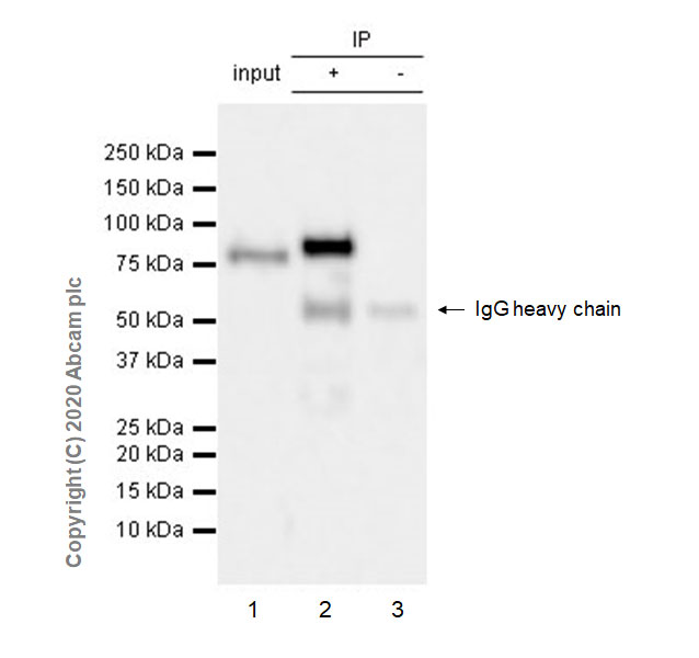 Immunoprecipitation - Anti-FOXP4 antibody [EPR22714-2] (AB242127), expandable thumbnail