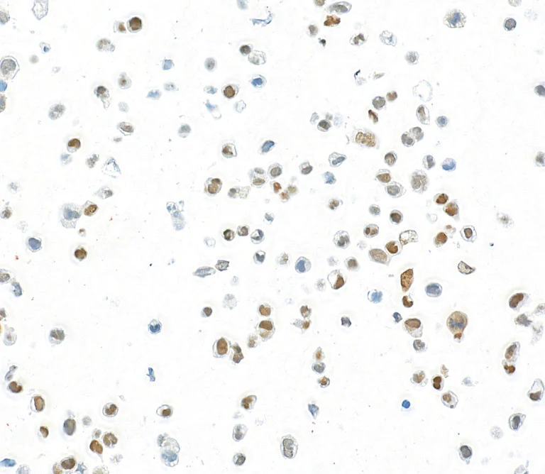 Immunocytochemistry - Anti-FOXQ1 antibody [BLR230K] - BSA free (AB314093)