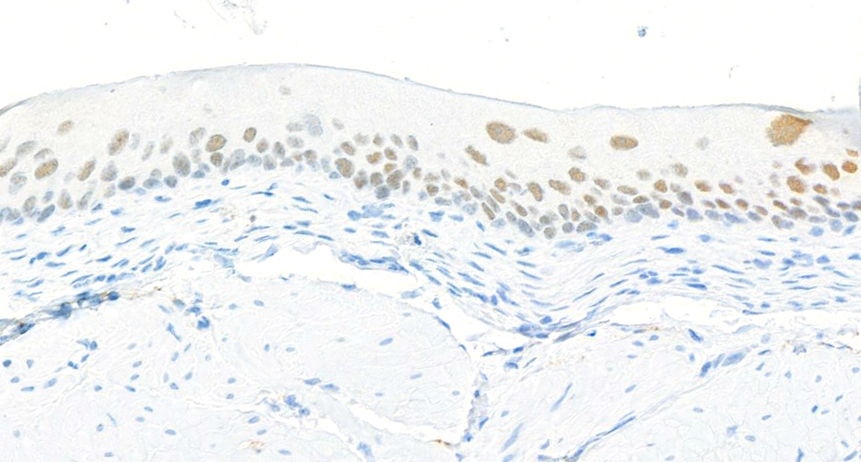 Immunohistochemistry (Formalin/PFA-fixed paraffin-embedded sections) - Anti-FOXQ1 antibody [BLR230K] - BSA free (AB314093), expandable thumbnail