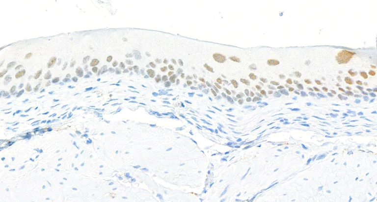 Immunohistochemistry (Formalin/PFA-fixed paraffin-embedded sections) - Anti-FOXQ1 antibody [BLR230K] - BSA free (AB314093)