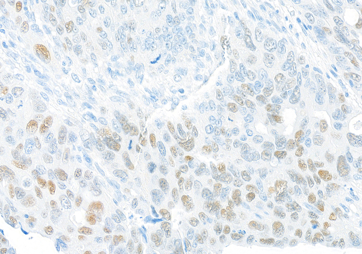 Immunohistochemistry (Formalin/PFA-fixed paraffin-embedded sections) - Anti-FOXQ1 antibody [BLR230K] - BSA free (AB314093), expandable thumbnail