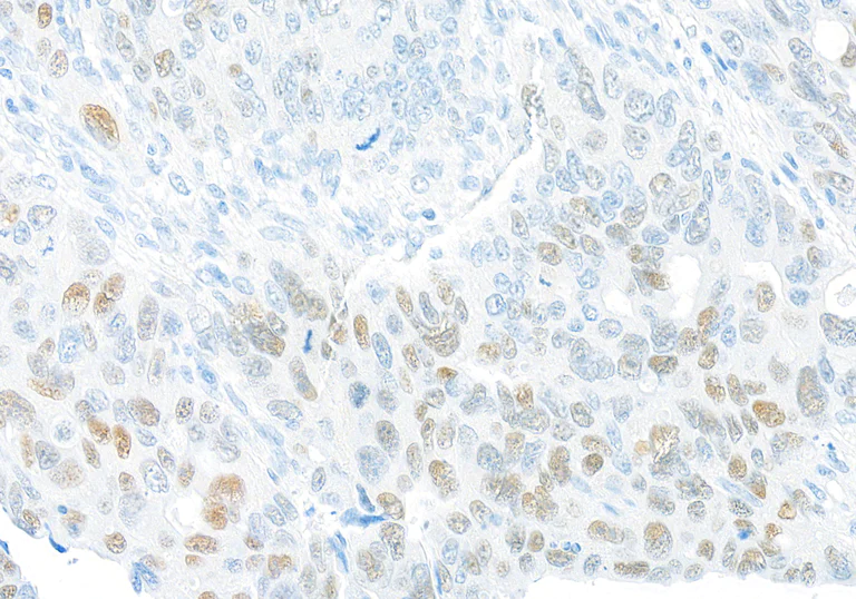 Immunohistochemistry (Formalin/PFA-fixed paraffin-embedded sections) - Anti-FOXQ1 antibody [BLR230K] - BSA free (AB314093)