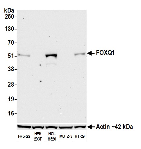 Western blot - Anti-FOXQ1 antibody [BLR230K] - BSA free (ab314093), expandable thumbnail