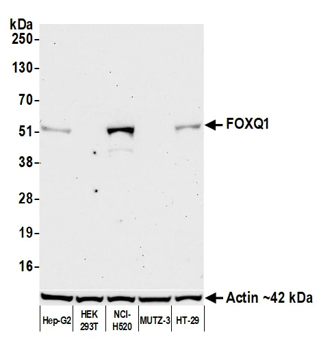 Western blot - Anti-FOXQ1 antibody [BLR230K] - BSA free (AB314093)