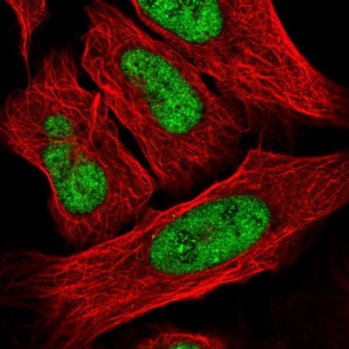 Immunocytochemistry/ Immunofluorescence - Anti-FOXR2 antibody (AB244513), expandable thumbnail