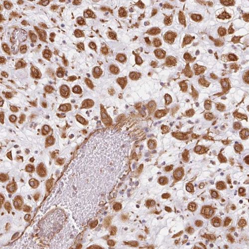 Immunohistochemistry (Formalin/PFA-fixed paraffin-embedded sections) - Anti-FOXR2 antibody (AB244513), expandable thumbnail
