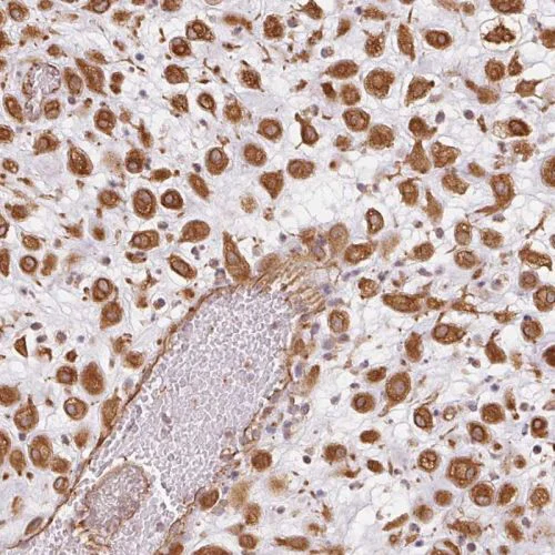 Immunohistochemistry (Formalin/PFA-fixed paraffin-embedded sections) - Anti-FOXR2 antibody (AB244513)