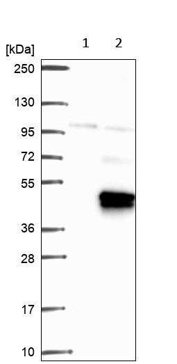 Western blot - Anti-FOXR2 antibody (AB244513), expandable thumbnail