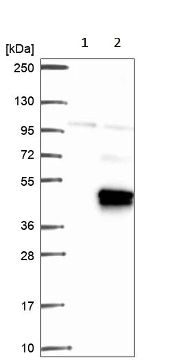 Western blot - Anti-FOXR2 antibody (AB244513)