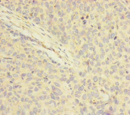 Immunohistochemistry (Formalin/PFA-fixed paraffin-embedded sections) - Anti-FOXRED1 antibody (AB229860)