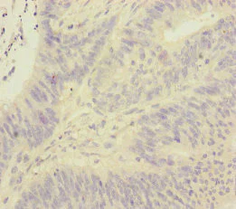 Immunohistochemistry (Formalin/PFA-fixed paraffin-embedded sections) - Anti-FOXRED1 antibody (AB229860)