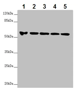 Western blot - Anti-FOXRED1 antibody (AB229860)