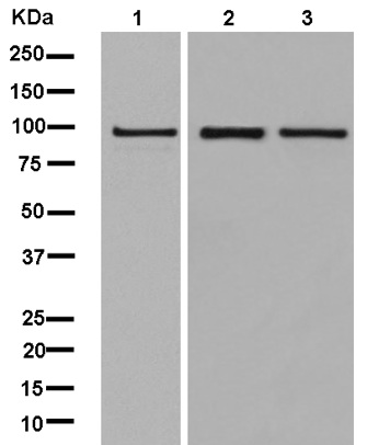 Western blot - Anti-FP100 antibody [EPR13721] (AB181185), expandable thumbnail