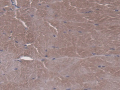 Immunohistochemistry (Formalin/PFA-fixed paraffin-embedded sections) - Anti-FPGS antibody (AB231540)