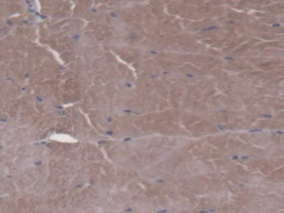 Immunohistochemistry (Formalin/PFA-fixed paraffin-embedded sections) - Anti-FPGS antibody (AB231540)