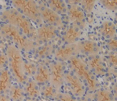 Immunohistochemistry (Formalin/PFA-fixed paraffin-embedded sections) - Anti-FPGS antibody (AB231540)