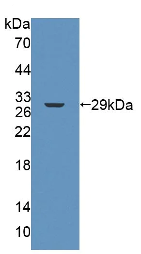 Western blot - Anti-FPGS antibody (AB231540)