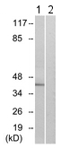 Anti-FPR1 antibody