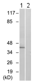 Western blot - Anti-FPR1 antibody (AB113531)