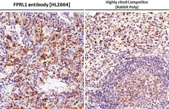 Immunohistochemistry (Formalin/PFA-fixed paraffin-embedded sections) - Anti-FPR2 antibody [HL2664] - BSA and Azide free (AB325854)