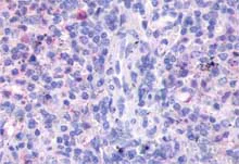 Immunohistochemistry (Formalin/PFA-fixed paraffin-embedded sections) - Anti-FPR3 antibody (AB150568)