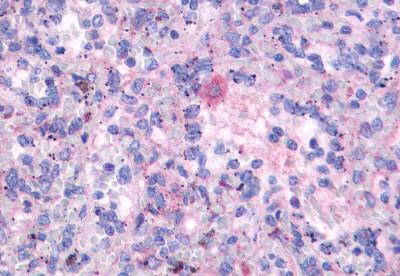 Immunohistochemistry (Formalin/PFA-fixed paraffin-embedded sections) - Anti-FPR3 antibody - N-terminal (AB188785)