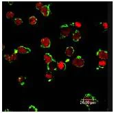 Immunocytochemistry/ Immunofluorescence - Anti-FPRL1/RFP antibody (AB63023)