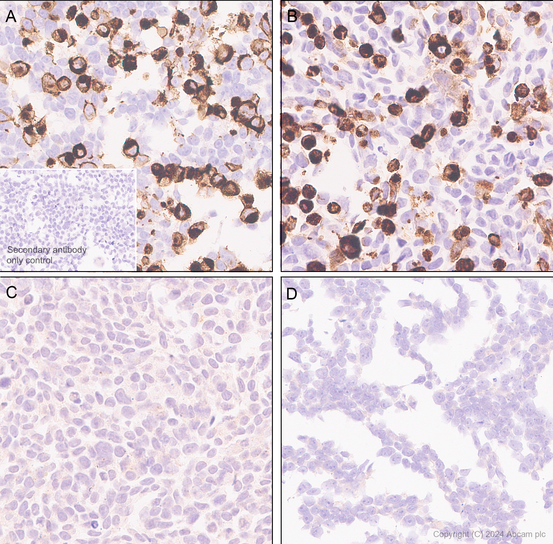 Immunohistochemistry (Formalin/PFA-fixed paraffin-embedded sections) - Anti-FPRL1/RFP + FPR3 antibody [EPR28515-94] (AB317815), expandable thumbnail