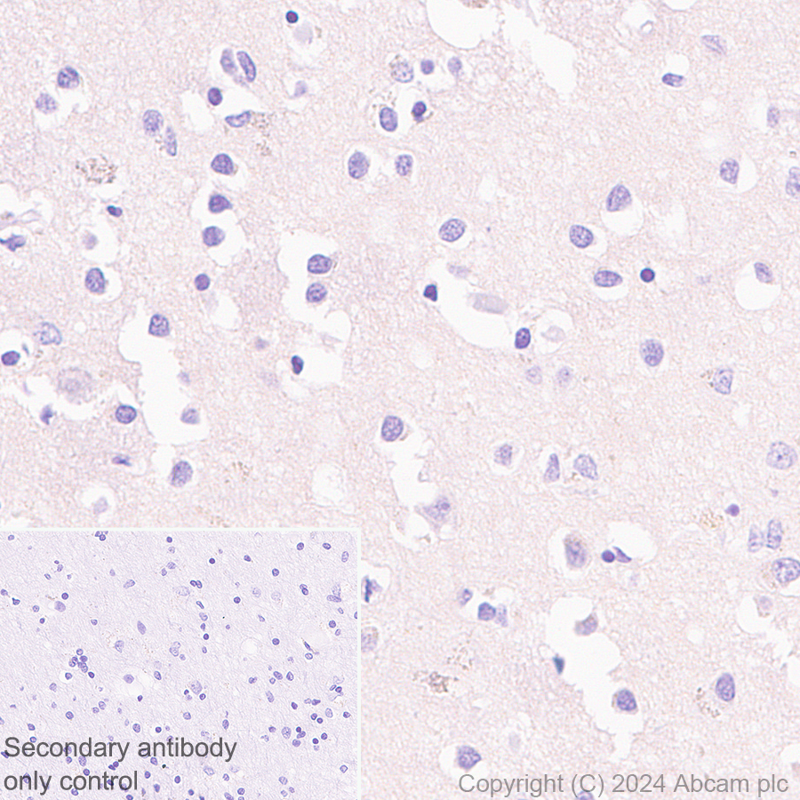 Immunohistochemistry (Formalin/PFA-fixed paraffin-embedded sections) - Anti-FPRL1/RFP + FPR3 antibody [EPR28515-94] (ab317815), expandable thumbnail