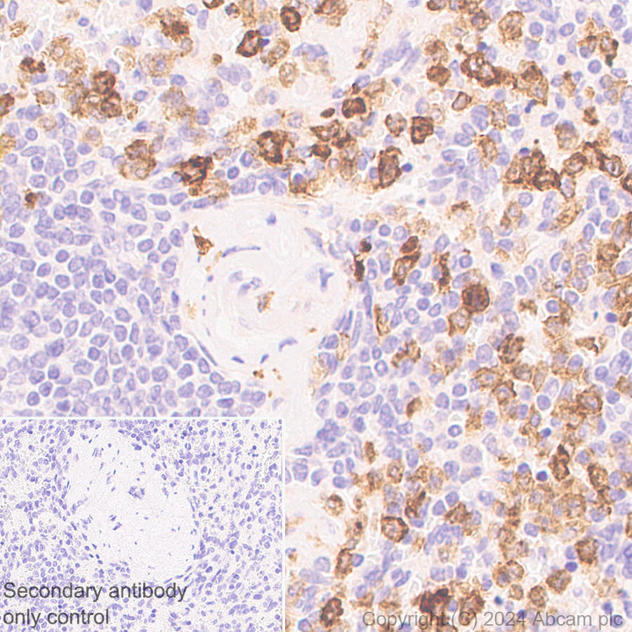 Immunohistochemistry (Formalin/PFA-fixed paraffin-embedded sections) - Anti-FPRL1/RFP + FPR3 antibody [EPR28515-94] (AB317815), expandable thumbnail