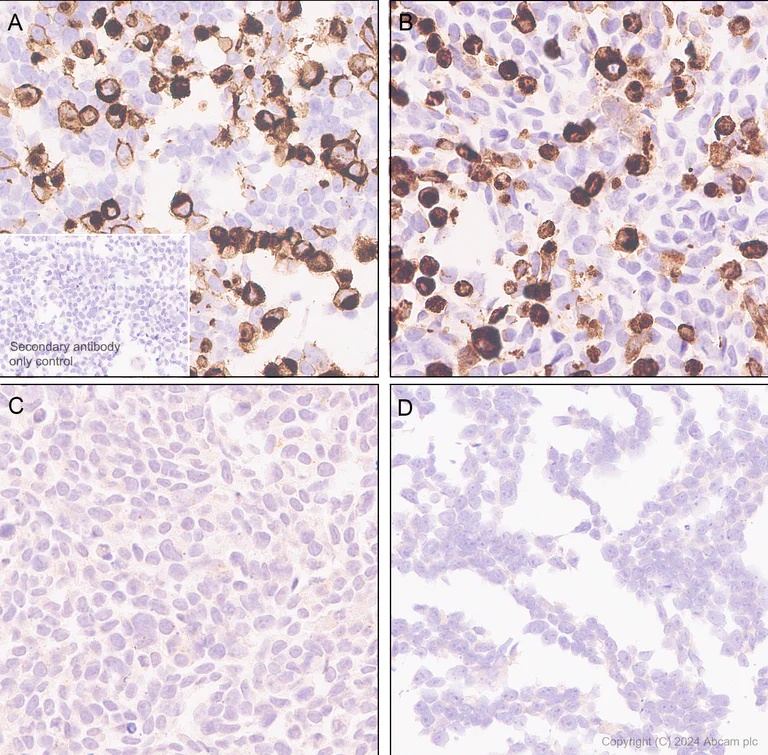 Immunohistochemistry (Formalin/PFA-fixed paraffin-embedded sections) - Anti-FPRL1/RFP + FPR3 antibody [EPR28515-94] - BSA and Azide free (AB317816)