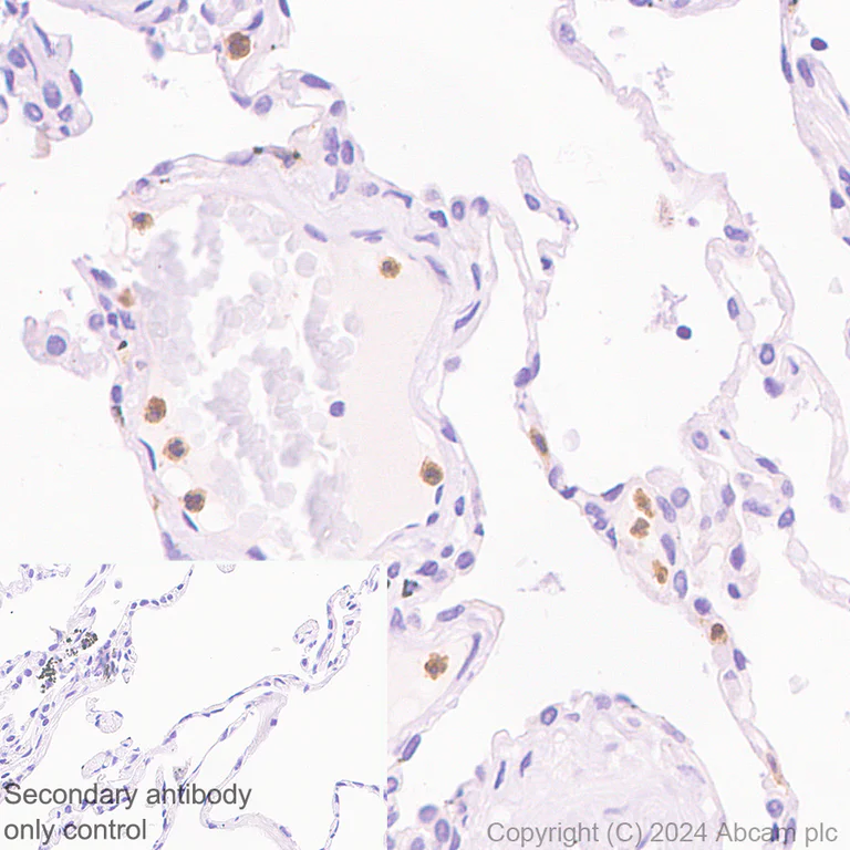 Immunohistochemistry (Formalin/PFA-fixed paraffin-embedded sections) - Anti-FPRL1/RFP + FPR3 antibody [EPR28515-94] - BSA and Azide free (AB317816)