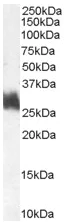 Western blot - Anti-FRA1 antibody (AB50426)