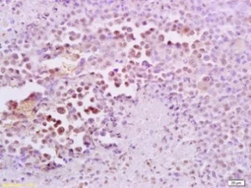 Immunohistochemistry (Formalin/PFA-fixed paraffin-embedded sections) - Anti-FRA2 antibody (AB216838)