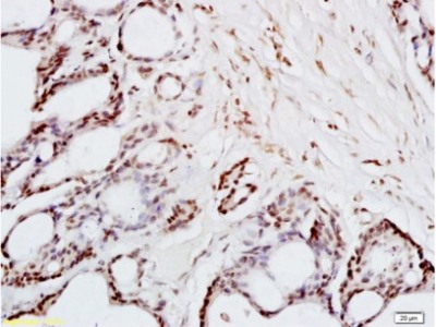 Immunohistochemistry (Formalin/PFA-fixed paraffin-embedded sections) - Anti-FRA2 antibody (AB216838)