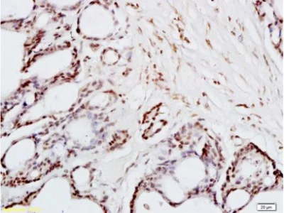 Immunohistochemistry (Formalin/PFA-fixed paraffin-embedded sections) - Anti-FRA2 antibody (AB216838)