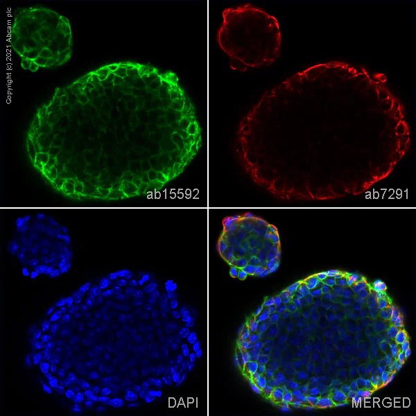 Immunocytochemistry/ Immunofluorescence - Anti-Fragilis antibody (AB15592)