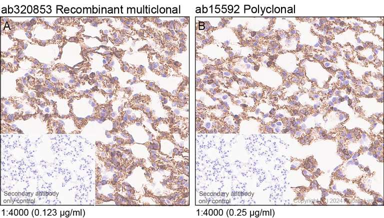 Immunohistochemistry (Formalin/PFA-fixed paraffin-embedded sections) - Anti-Fragilis antibody (AB15592)