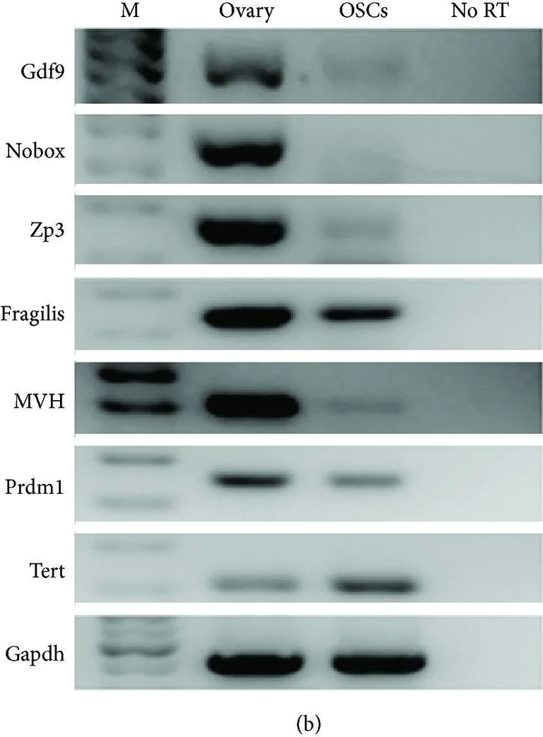 Western blot - Anti-Fragilis antibody (AB15592)