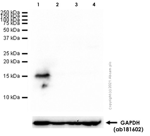 Anti-Fragilis antibody [EPR5242]