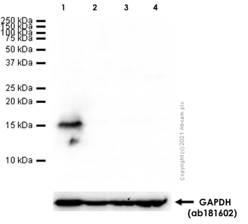 Western blot - Anti-Fragilis antibody [EPR5242] (AB109429)