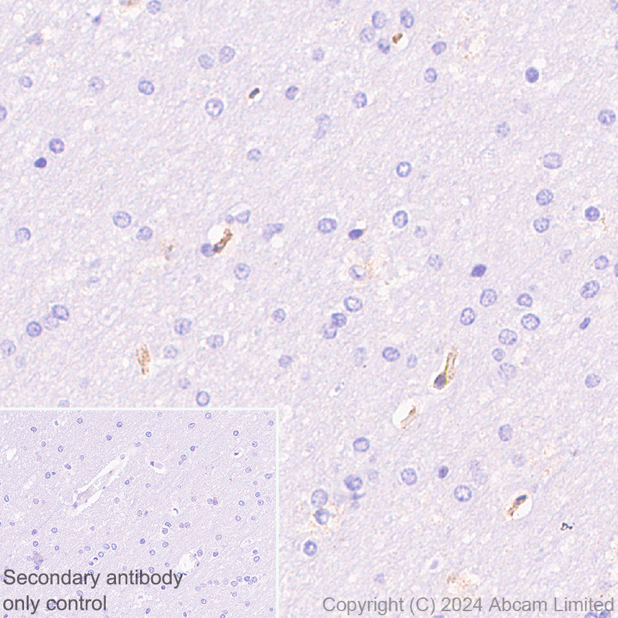 Immunohistochemistry (Formalin/PFA-fixed paraffin-embedded sections) - Anti-Fragilis antibody [RM1224] (AB320853)