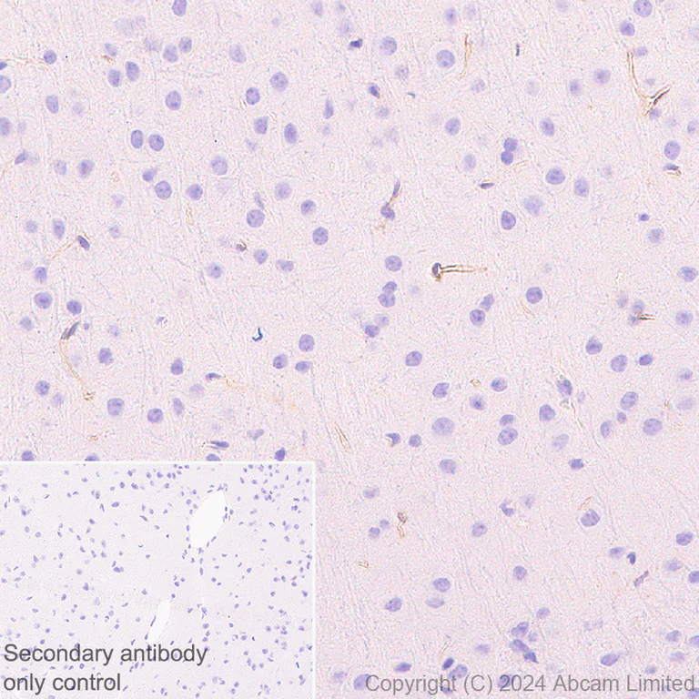 Immunohistochemistry (Formalin/PFA-fixed paraffin-embedded sections) - Anti-Fragilis antibody [RM1224] (AB320853)