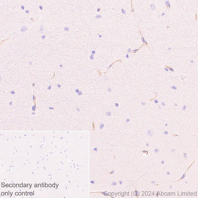 Immunohistochemistry (Formalin/PFA-fixed paraffin-embedded sections) - Anti-Fragilis antibody [RM1224] (AB320853)