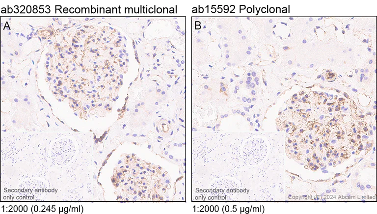 Immunohistochemistry (Formalin/PFA-fixed paraffin-embedded sections) - Anti-Fragilis antibody [RM1224] - BSA and Azide free (AB320854)